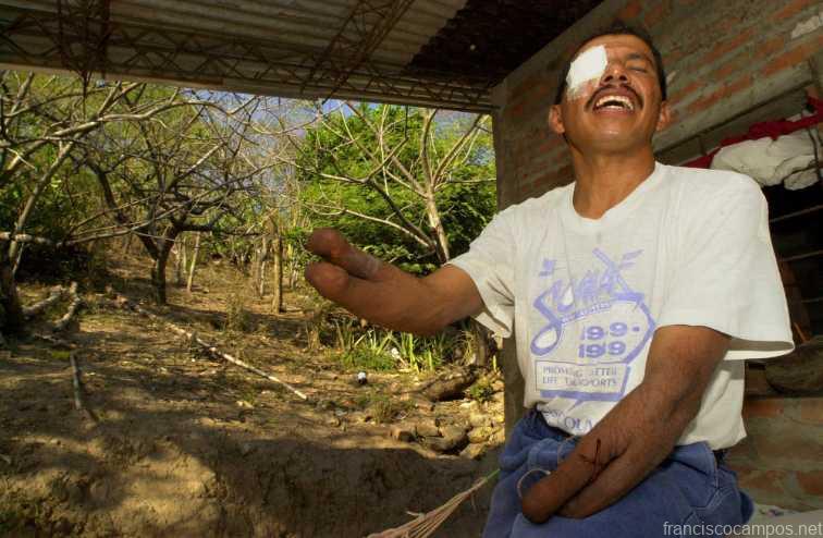 VIDEO. Veteranos de guerra: «Nos prometieron la gloria»